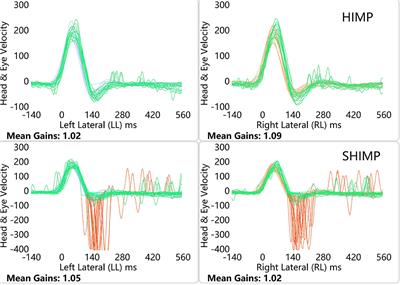 Association Analysis of HIMP and SHIMP Quantitative Parameters in Patients With Vestibular Neuritis and Healthy Participants